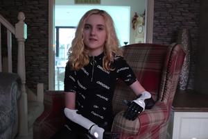 卡梅隆团队为13岁女孩打造机械手臂