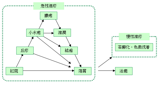 湿疹の三角形