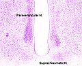 Cross-section of the monkey hypothalamus displays two of the major hypothalamic nuclei on either side of the fluid-filled third ventricle.