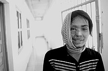 Photo du visage bandé d'une femme portant les traces d'une attaque à l'acide.