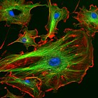 内皮細胞の蛍光顕微鏡像