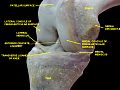 Knee joint.Deep dissection. Anteromedial view.