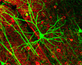 Door middel van groen fluorescent proteïne zichtbaar gemaakte piramidecel (gfp)