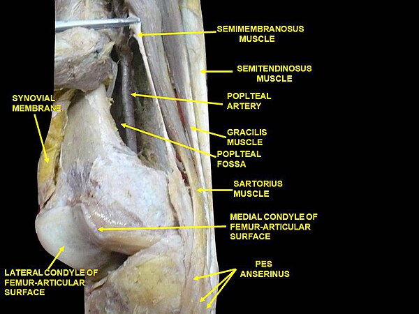 Muscles of thigh. Lateral view.