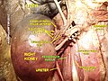 Muscle grand psoas.