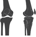 Anterior and lateral view of knee.