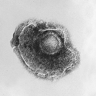 Prikaz elektronskom mikroskopijom virusa varičele zoster, izazivača vodenih boginja i njegove (prikrivene-latentne) lokalizacija u nervnom sistemu iz koje virusi mogu preći u reinfekciju-nakon inkubacije (1-3 nedelje).