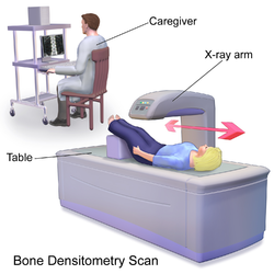 Bone densitometry scan.