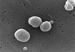 Streptococcus pneumoniae under elektronmikroskop