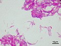 Mycobacterium bovis