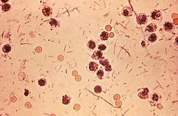 мікрофотографія Shigella sp. у зразку калу