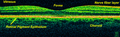 OCT vremenskog domena mrljinog područja mrežnjače na 800 nm, aksijalna rezolucija 3 µm