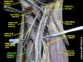 Adductor magnus muscle