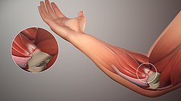 Description de l'image Golfers-Elbow SAG.jpg.