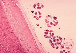 Histología (anatomía microscópica) del quiste de E. granulosus