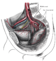 Bifurcația aortei și a arterei iliace comune drepte - vedere laterală. Artera hipogastrică este un termen vechi pentru artera iliacă internă⁠(d) . (Com. Iliac. A. Este vizibil în centrul stânga jos.)