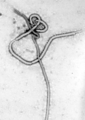 El Virus Ébola (Filovirus) tiene forma filamentosa y produce fiebre hemorrágica viral.