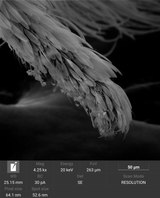 high resolution SEM image of Psychodidae (drain- or moth flies) leg