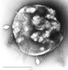 Sulfolobus, инфицированный вирусом Sulfolobus tengchongensis spindle-shaped virus 1 (STSV-1)[1][2][3][4]. В левой и нижней частях фотографии видны две вирусные частицы веретеновидной формы, отпочковывающиеся от клетки археи. Масштаб = 1 мкм