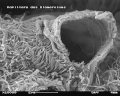 Glomerulus mit gebrochener Kapillare im REM. Bildbreite 11,5 µm.