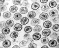 VIH (Lentivirus), el virus causante del SIDA.