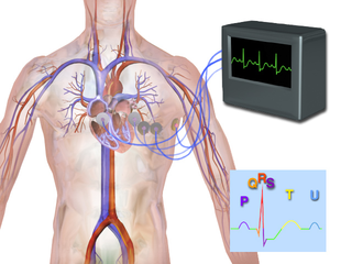 Electrocardiography.