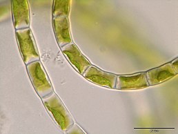 Klebsormidium bilatum