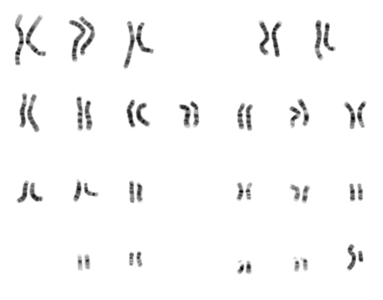 Micrograph of human male chromosomes using Giemsa stain, followed by sorting and grayscaling.