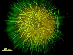 Colonie en forme de boule formée par une des espèces de Gloeotrichia (vue au microscope, avec coloration).