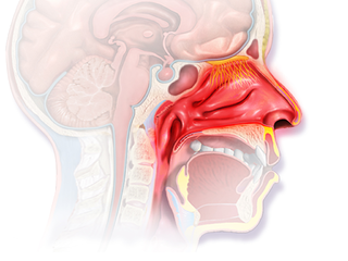 Allergic rhinitis.