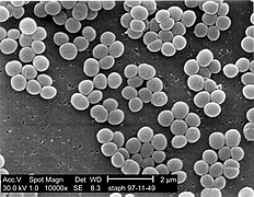 Staphylococcus aureus