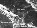 Lebersinusoid und Disse-Raum