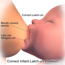 Correct latch-on in breastfeeding.