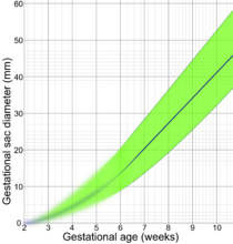 Gestational sac diameter by gestational age