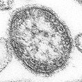Morbillivirus (sección). Este virus causa sarampión.