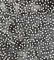 Partícules de l'antigen HBsAg vistes al microscopi electrònic.