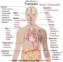 Main side effects of tramadol. Red color denotes more serious effects, requiring immediate contact with health provider.<ref>{{cite web