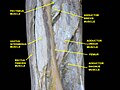 Muscles of thigh. Anterior views.