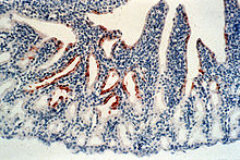 "Avian avulavirus 1" in the conjunctiva of a chicken