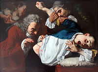 Gaspare Traversi, La Chirurgie, 1753-54.