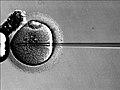 Iniezione in un oocita di sperma attraverso la tecnica della Iniezione intracitoplasmatica dello spermatozoo (ICSI).