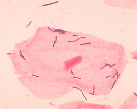 L. acidophilus около клеток вагинального эпителия