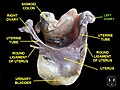 Left ovary