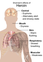 Main short-term effects of heroin usage.[4]