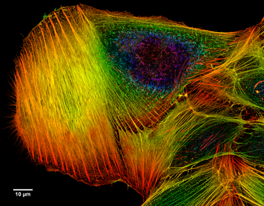 Confocal microscope image