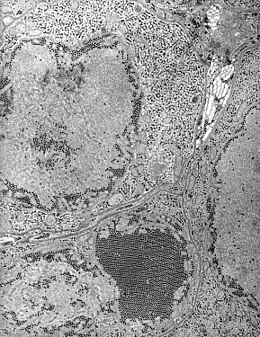 Description de l'image St. Louis Encephalitis (SLE) virus EM PHIL 1871 lores.JPG.