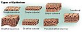 Types of epithelium