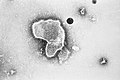 Respiratorisches Synzytial-Virus