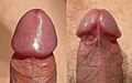 Corona of the glans penis (erect penis)