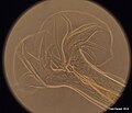 Posterior end of a nematode (5)
